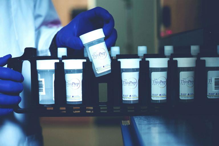 トレイから検体を取り出している手袋をはめた手