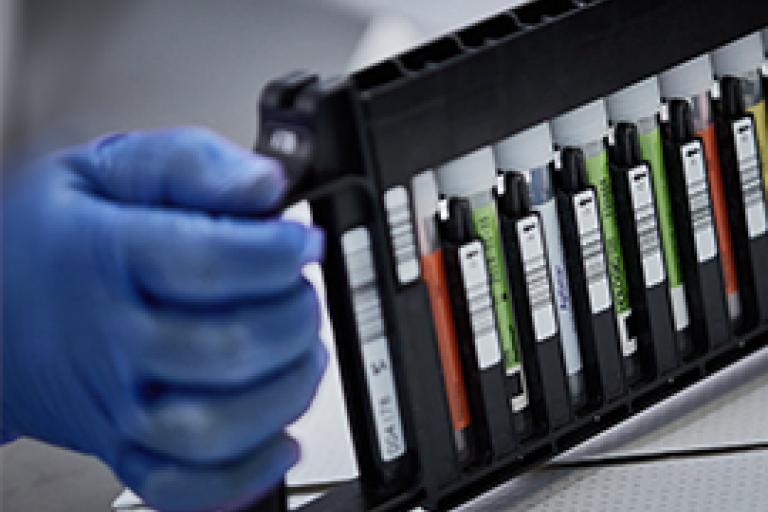 手袋をした手でバイアルのラックを持っている