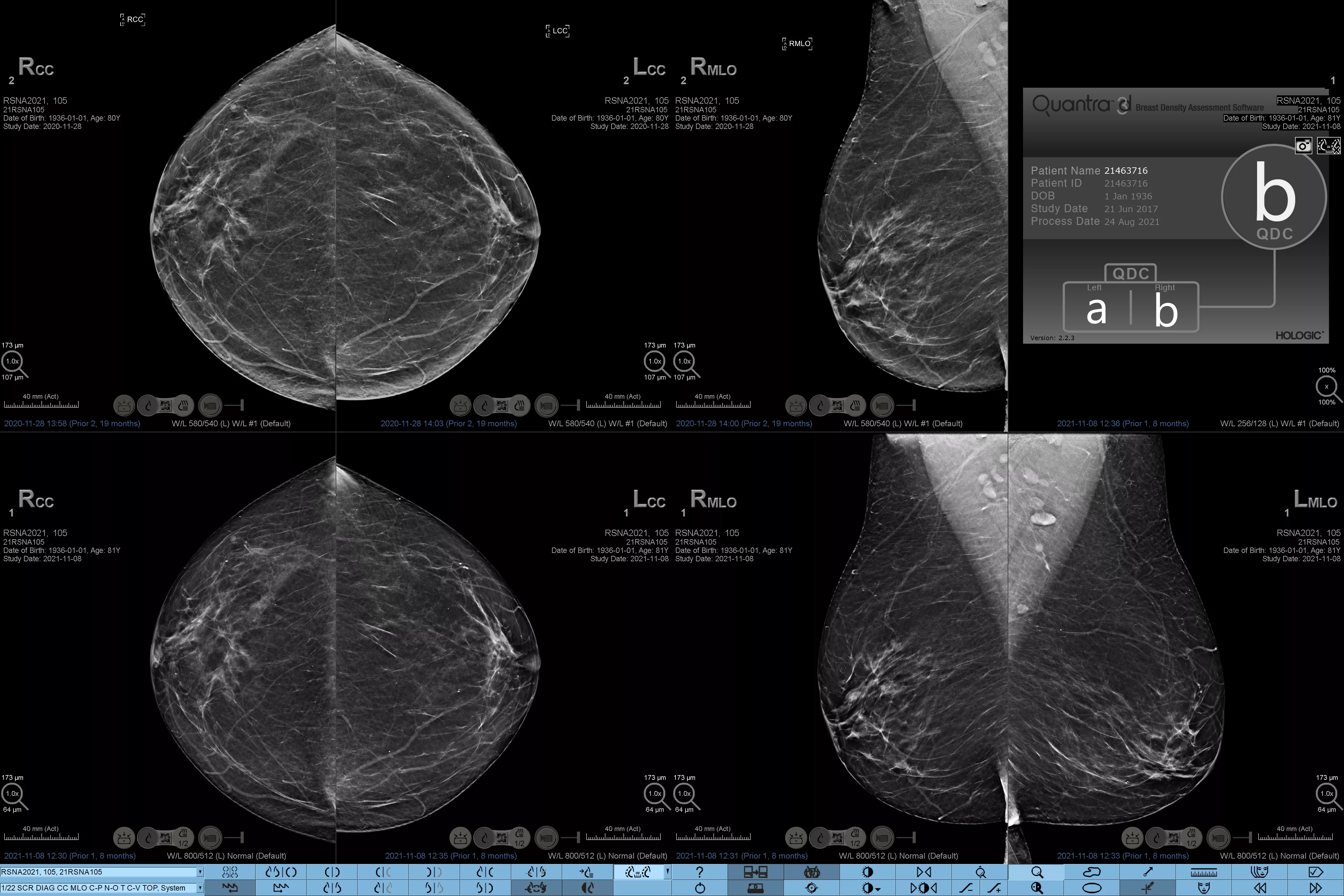 白い背景にトランスデューサー-L18-5
