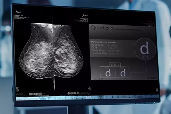 測定値とデータを表示するモニターの拡大画像