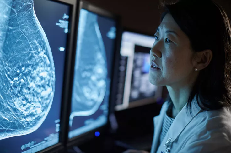 モニター上の X 線画像を見ている医療専門家